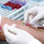 Análisis de detecciones gratuitos de HIV/SIDA en el SAMCo