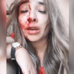 MARIA JUANA – Una joven se filmó ensangrentada para denunciar que su ex novio la golpeó salvajemente