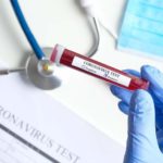 CORONAVIRUS – Los protocolos y recomendaciones de la Organización Mundial de la Salud